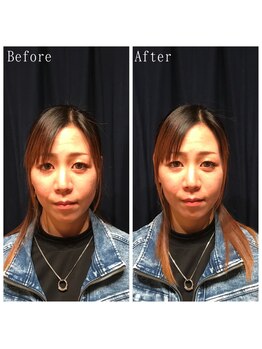 たくろう鍼灸院 豊田本院/Before＆After