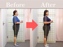 やわた姿勢整体院/59歳女性