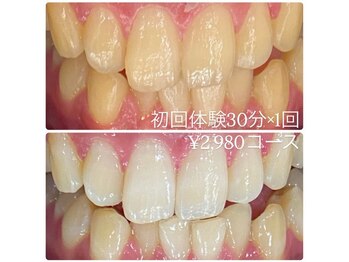 ホワイトニングルーム 横浜店(Whitening Room)/セルフホワイトニング/横浜