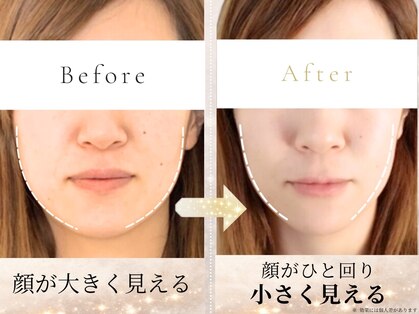 アロハ(ALOHA.)の写真