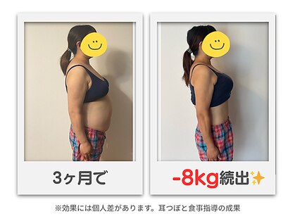 天使の耳の写真