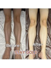 ステイゴールド 新百合ヶ丘(STAY GOLD)/剃るなら脱毛をおすすめします☆