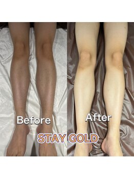 ステイゴールド 新百合ヶ丘(STAY GOLD)/剃るなら脱毛をおすすめします☆