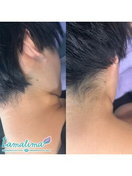 ラマリマ(Lamalima)/うなじワックス