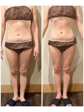 ルネ(Lune)/～施術前と施術後のお写真撮影～