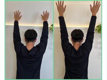 リセットモア(Reset More)/before after 1回の施術の変化