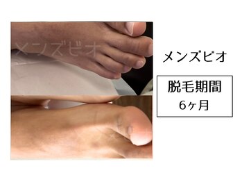 メンズビオ 神戸三宮店/