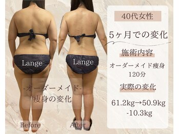 サロン ド ボーテ ラーンジュ 岐阜店(salon de beaut'e L'ange)/ハイパ-ナイフEX2ダイエット痩身