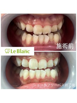 ルブラン 奈良店(Le Blanc)/学生様限定のショートフリーパス