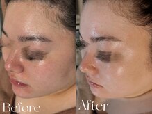 ウィハナ(wehana)/【セラピール】透明感/赤みケア