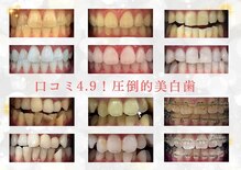 ホワイトニングショップ 府中店