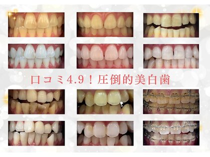 ホワイトニングショップ 府中店の写真