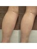 【60分でサクッと♪】浮腫み足撃退!下半身痩せ集中RAFOSコース 60分