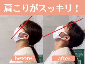 整体院 ひなどり/肩こりがすっきり!