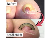 巻き爪矯正センター 沖縄 宜野湾の雰囲気（つらい痛みを繰り返す巻き爪の方も◎）