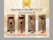 ソウソウビューティー 五反田(Shou Shou Beauty)