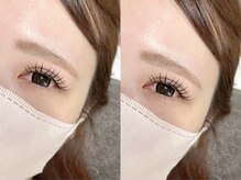 エルミュ(Elmu)/フラットラッシュ