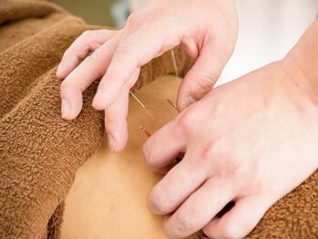 南行駅近整骨院の写真/【整体×鍼のWアプローチ】痛みを最小限に抑えた施術で全身のコリ/痛みを徹底改善◎