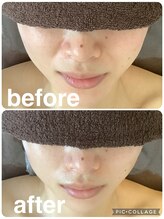 ギンザアール(GINZA R.)/