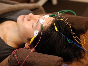 フラット(flat)の写真/"脳疲労"と"眼精疲労"に特化!3月限定【電気を流す頭皮鍼+ほぐし付】¥6980!肩こり/頭がだる重い/浮腫みにも