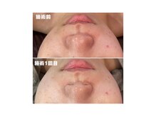 バルディーナ(BALDINA)