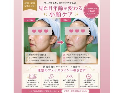 アカツキファイブ(AKATSUKI5)の写真