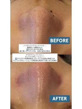 アイリス(AiRiS)/◎開き毛穴