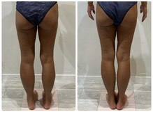 ビンナ 五反田店(Binna)/姿勢改善