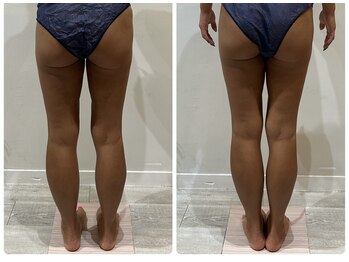 ビンナ 五反田店(Binna)/姿勢改善