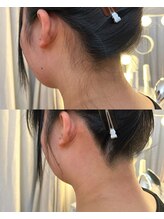 シェリー(Cherie)/うなじWAX+光脱毛