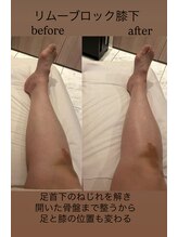 シェリーナ(cherieNa)/リムーブロックフット