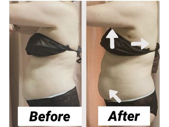 リシェカ(Richeka)/気になる下腹部撃退