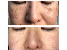 エターナルビューティー(eternal beauty)/