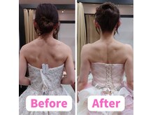 オハナ整骨院(Ohana整骨院)/【華奢見え】ドレス映え！