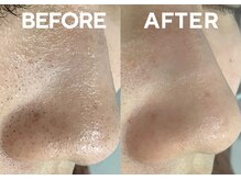 ベベ 高崎本店(Be'be')の雰囲気（黒ずみ/詰まり/開き…毛穴悩みは毛穴専門店で改善）