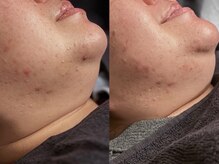 ペリドット(Peridot)/