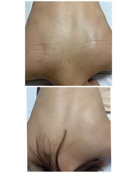 リクラ 北千住(Reclat)/ダクトピール1回