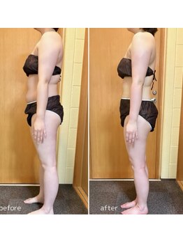 アンドワイ バイ サロンリーナ(&y by Salon Lena)の写真/2桁減量◎全身集中燃焼★【燃焼マシーン×全身強力揉みだしリンパ¥13,960】無料カウンセリング実施中!