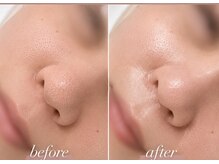 マグノリア(Magnolia)の雰囲気(【たるみ改善】表情筋の引き締めにEMS。たるみ改善に◎)