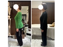 ボーンズ(BONES)/骨格改善