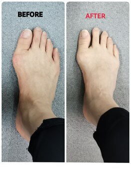 五反田整体 身体改善整体院/足の指のお悩み改善整体