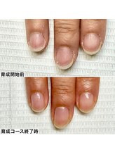 ベッレ マーニ/桃色美爪育成コース