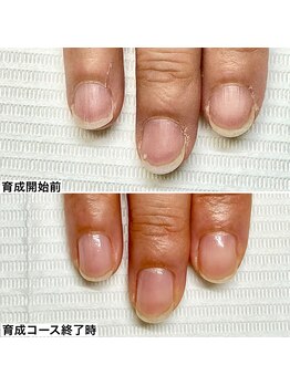 ベッレ マーニ/桃色美爪育成コース