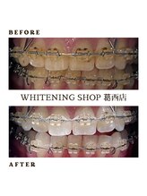 ホワイトニングショップ 葛西店/矯正中の方も◎