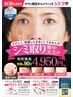 【平日限定】シミケア集中フェイシャルエステ★1回90分￥4,950　