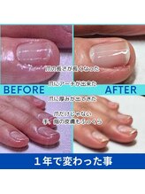マユネイル(mayunail)/1年の変化♪