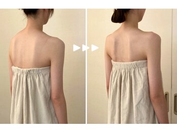 アマリエ/before after