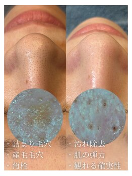 マシロ(MA SHIRO)/泡ピーリング×毛穴洗浄×マスク