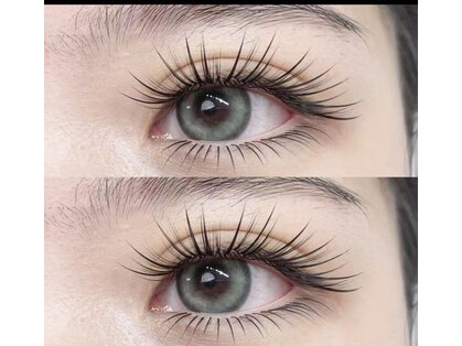 アイブライト(EYE Bright)の写真