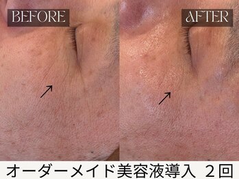スキンジム(SKIN GYM)/年齢を感じさせない目元へ